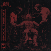 Dack Janiels: SHOCK THERAPY