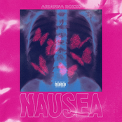 Nausea
