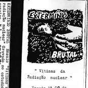 Vitimas Da Radiação Nuclear