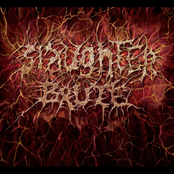 NERVE CONDUCTION VELOCITY