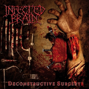 Ultima Ratio by Infected Brain