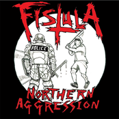 Fistula: Northern Aggression