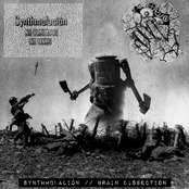 Synthmolación / /  Brain Dissection