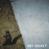 Dry Socket