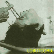 Lobotoomia