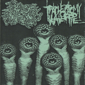 amoebe & tracheotomy waterpipe