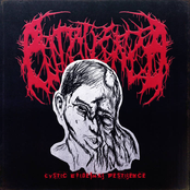 Cystic Epidermal Pestilence