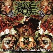 Decomposition And Sickness