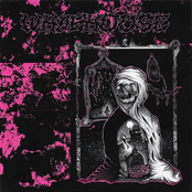 Sleep/Dementia