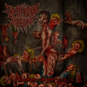 Anal Torture by Sixpounder Teratoma