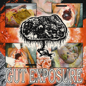 GUT EXPOSURE