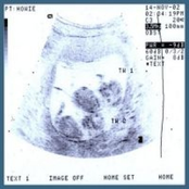 Tiny Pushes Vol.2 (All the Wrong Buttons)