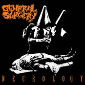 An Orgy Of Flying Limbs And Gore by General Surgery