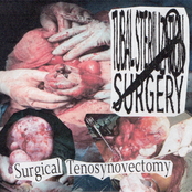 Surgical Tenosynovectomy
