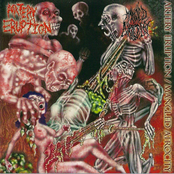 Split CD