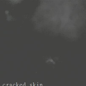 Cracked Skin