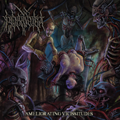 Ameliorating Vicissitudes - Single