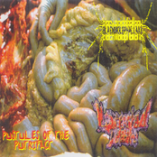 Pustules Of The Putrifact [2-Way Split]