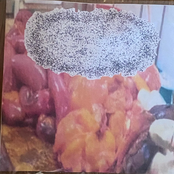 Hydroencephalocystocele