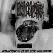 Metamorphosis of the Neck Musclulatur as Aftermath of an Knife Attack