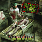 Flatulent Autopsy