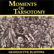 Moments Of Tarsotomy