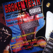 Broken Teeth