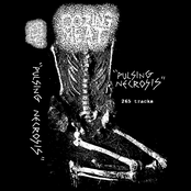 "Pulsing Necrosis" 265 Tracks