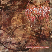 Putrified Vaginal Infibulation