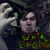 Genital Evisceration