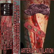 ARTERIAL MUTILATION