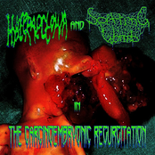The Carcinoembryonic Regurgitation [Split]
