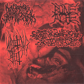 Blenorrhagical Spermatocystitis / Vomiting Shit / BoneAche / Wrong Illegal Abortion Procedure With Alarming Consequences