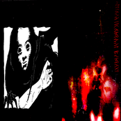 how to treat serotonin syndrome