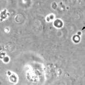 Dysmorphonica