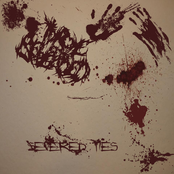 Severed Ties