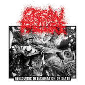 Neurologic Determination of Death