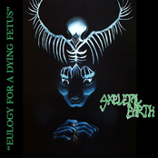 Eulogy For A Dying Fetus