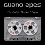 The Best & The Lost (T)apes