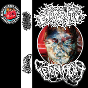 Endocarditis / Fetophagia