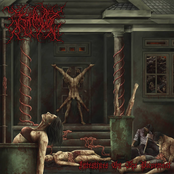 Intestines On The Pavement