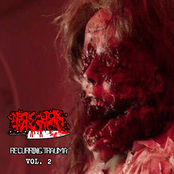 RECURRING TRAUMA VOL. 2