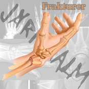 Frakturer