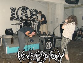 Avatar for Hemispherectomy