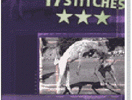 Avatar for 17 Stitches