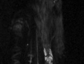 Avatar for Digerdöden