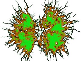 Infected Gastroenteritis 的头像