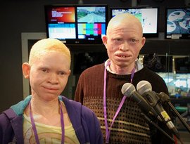 Tanzania Albinism Collective 的头像