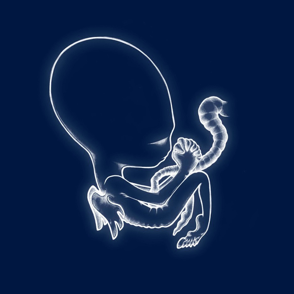 Svefn-g-englar - Sigur Rós