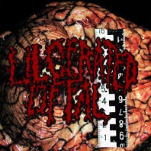 Avatar di Ulcerated Offal